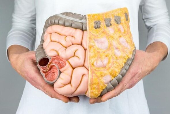 75ab4221-5b23-467d-b7b5-1bcd1318e3e3_169