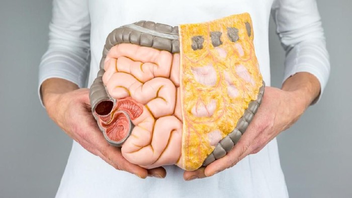 75ab4221-5b23-467d-b7b5-1bcd1318e3e3_169