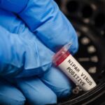 virus-nipah-1769414647781_169