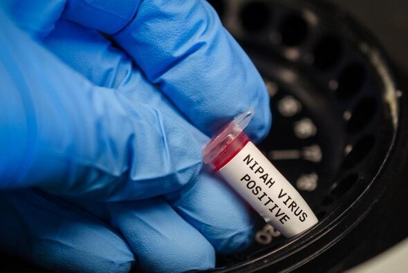 virus-nipah-1769414647781_169