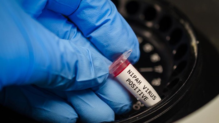 virus-nipah-1769414647781_169